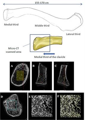 Age-Related Trends in the Trabecular Micro-Architecture of the Medial Clavicle: Is It of Use in Forensic Science?